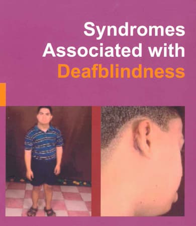 Cover page of Syndromes Associated with Deafblindness