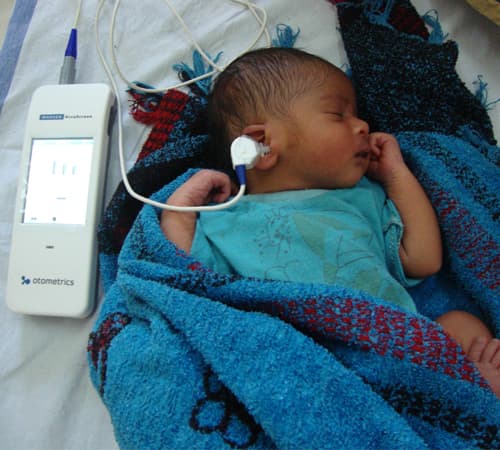A new born baby being screened for hearing impairment